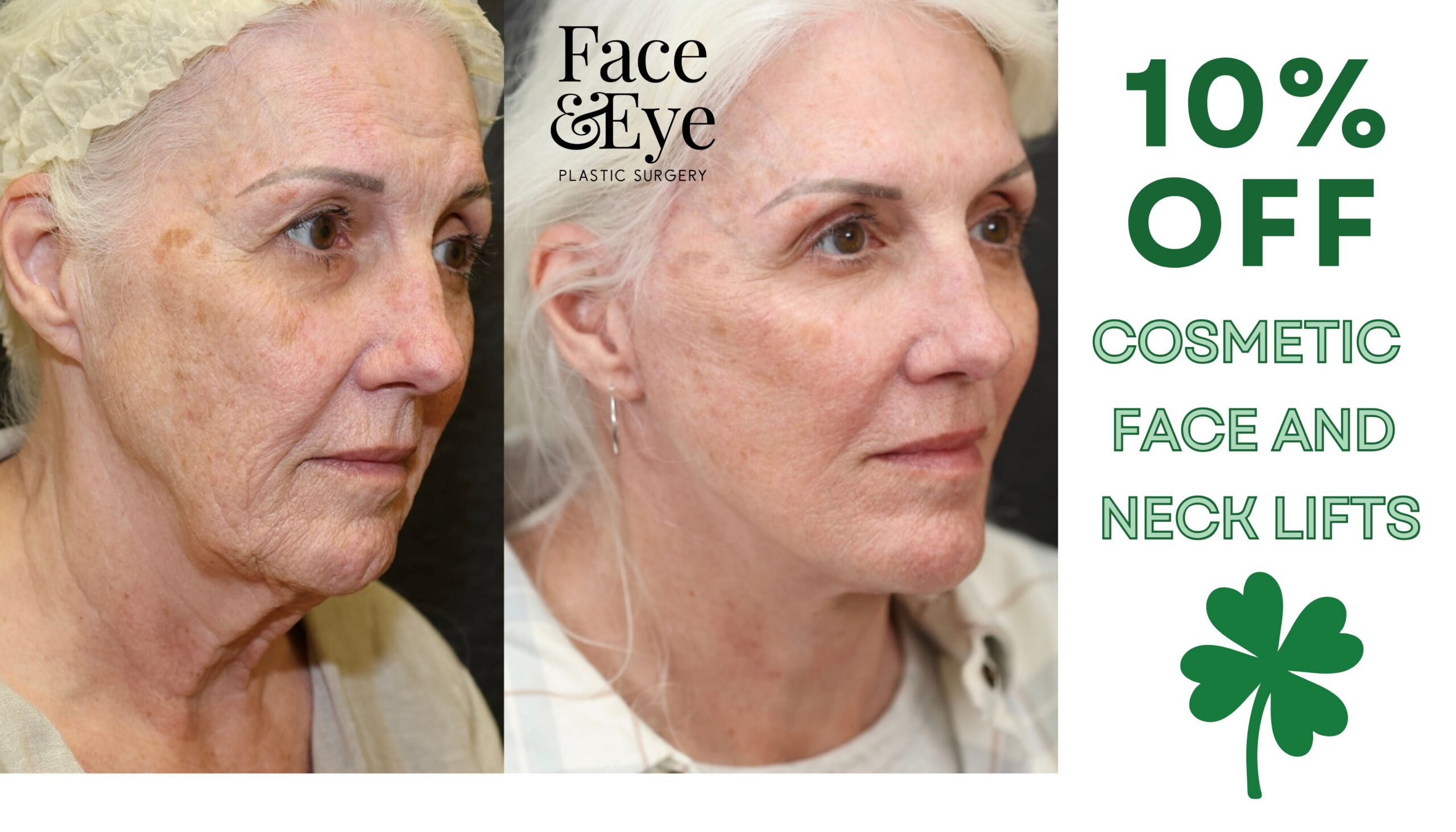 10% OFF Lift (7 x 4 in) (1)